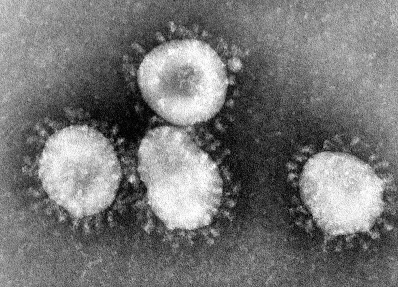 Photo credit: CDC Dr Fred Murphy PD-USGov-HHS-CDC https://commons.wikimedia.org/wiki/File:Coronaviruses_004_lores.jpg